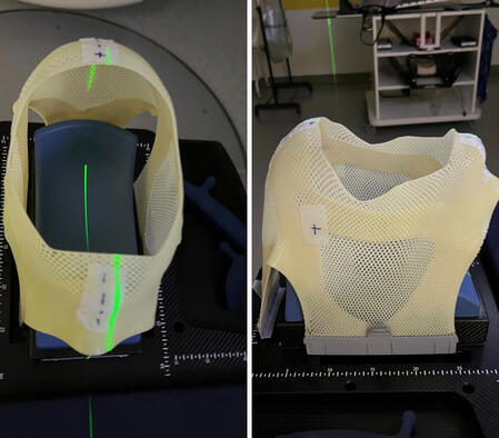 Radiotherapy mask Radiotherapy mask